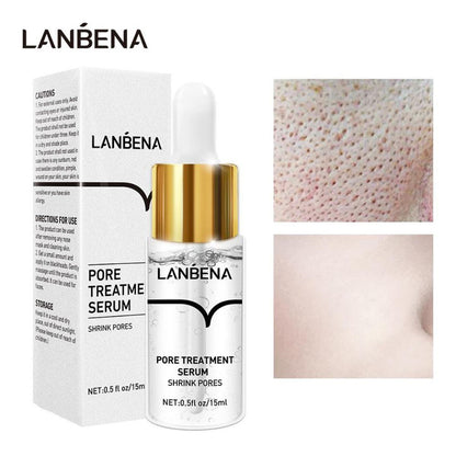 Máscara Facial Removedor de Cravos