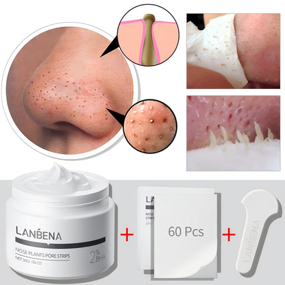 Máscara Facial Removedor de Cravos